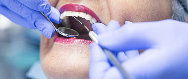 Emergency Dental Filling Replacement in WY